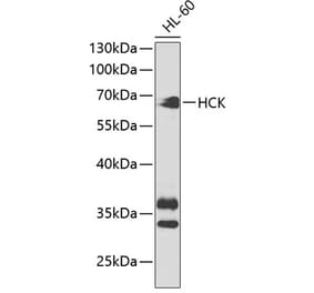 Western Blot - Anti-Hck Antibody (A13853) - Antibodies.com