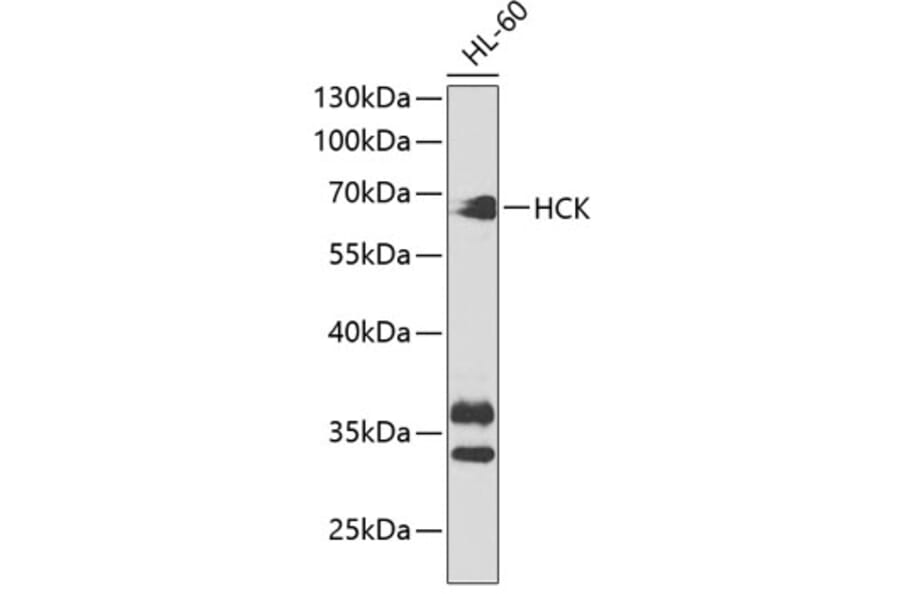 Western Blot - Anti-Hck Antibody (A13853) - Antibodies.com
