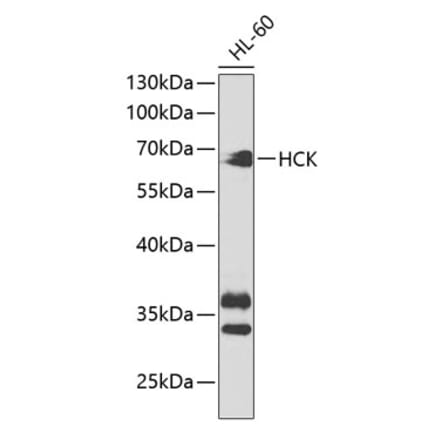 Western Blot - Anti-Hck Antibody (A13853) - Antibodies.com