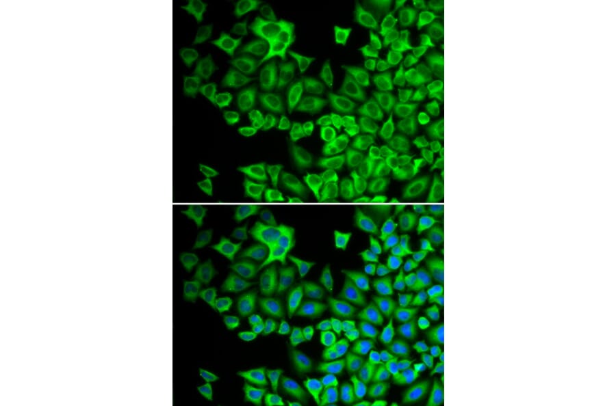Immunofluorescence - Anti-Hck Antibody (A13853) - Antibodies.com