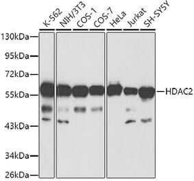 Western Blot - Anti-HDAC2 Antibody (A13854) - Antibodies.com