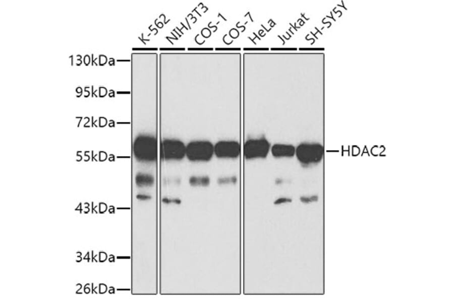 Western Blot - Anti-HDAC2 Antibody (A13854) - Antibodies.com