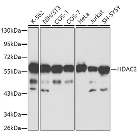 Western Blot - Anti-HDAC2 Antibody (A13854) - Antibodies.com