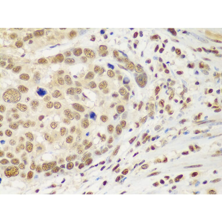 Immunohistochemistry - Anti-HDAC2 Antibody (A13854) - Antibodies.com