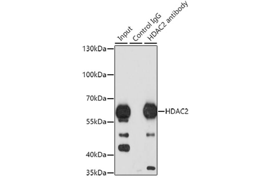 Western Blot - Anti-HDAC2 Antibody (A13854) - Antibodies.com