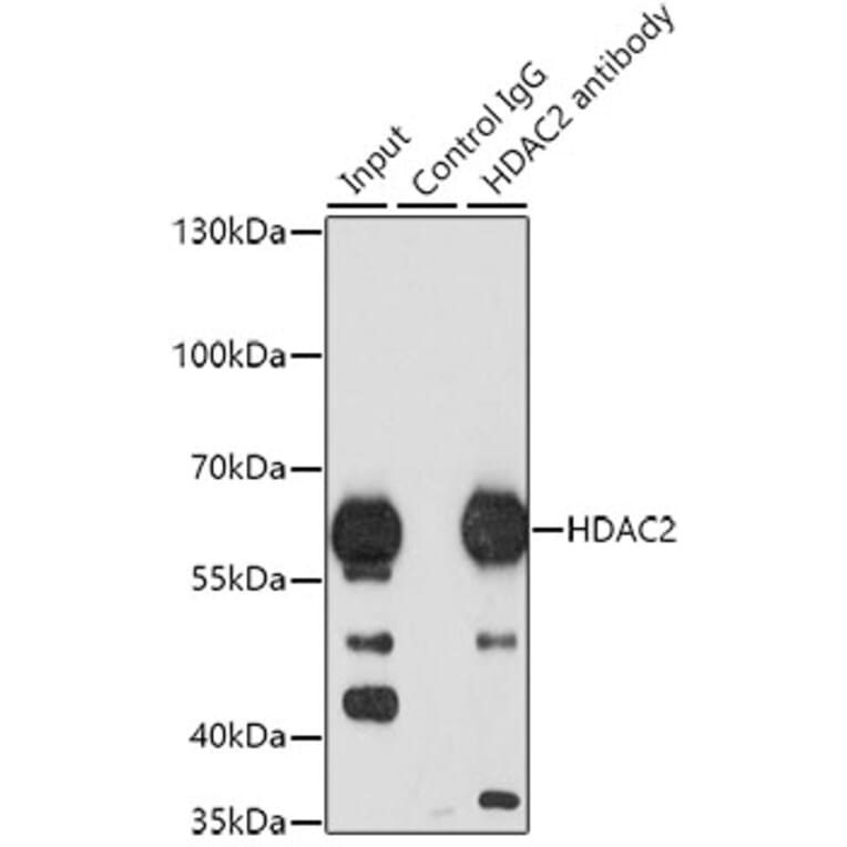 Western Blot - Anti-HDAC2 Antibody (A13854) - Antibodies.com