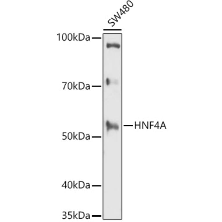 Western Blot - Anti-HNF-4-alpha Antibody (A13855) - Antibodies.com