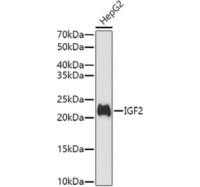 Western Blot - Anti-IGF2 Antibody (A13856) - Antibodies.com