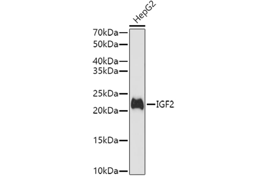 Western Blot - Anti-IGF2 Antibody (A13856) - Antibodies.com