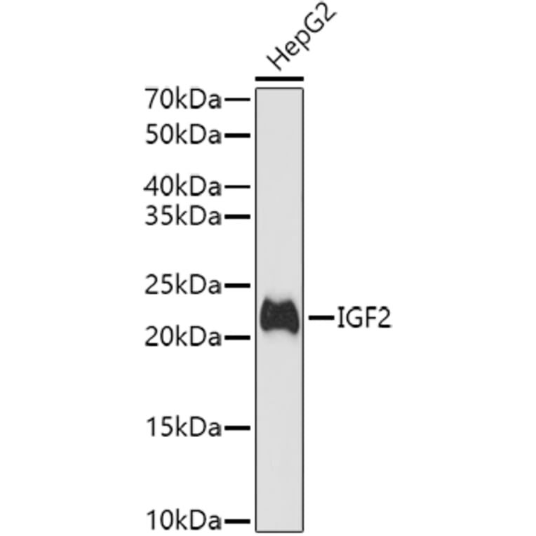 Western Blot - Anti-IGF2 Antibody (A13856) - Antibodies.com
