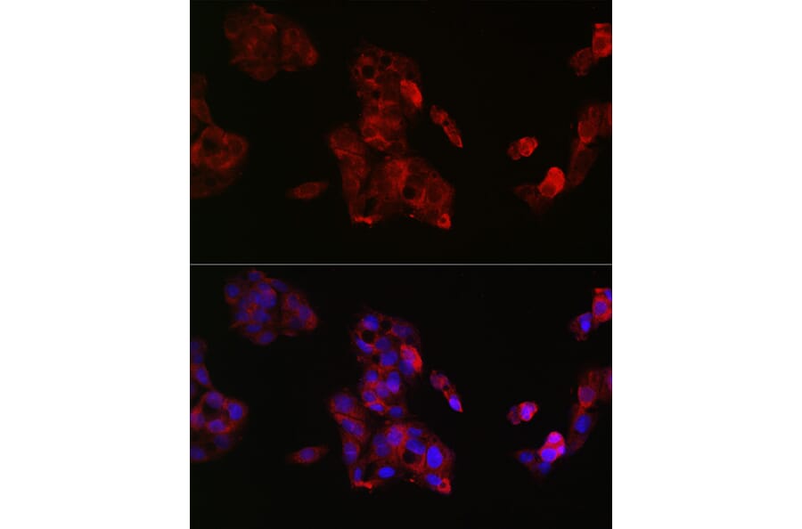Immunofluorescence - Anti-IGF2 Antibody (A13856) - Antibodies.com
