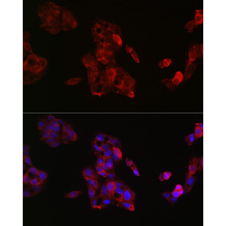 Immunofluorescence - Anti-IGF2 Antibody (A13856) - Antibodies.com