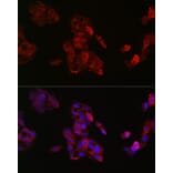 Immunofluorescence - Anti-IGF2 Antibody (A13856) - Antibodies.com