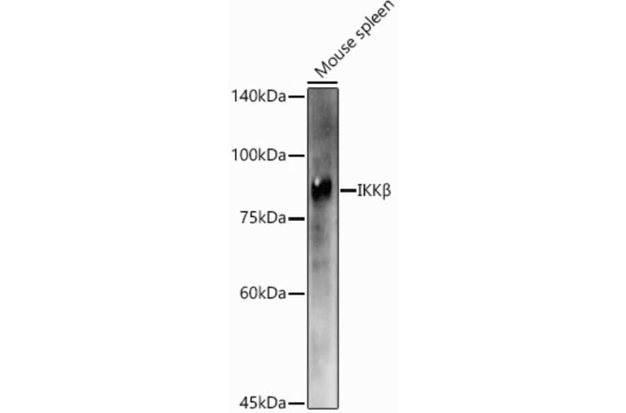 Western Blot - Anti-IKK beta Antibody (A13857) - Antibodies.com