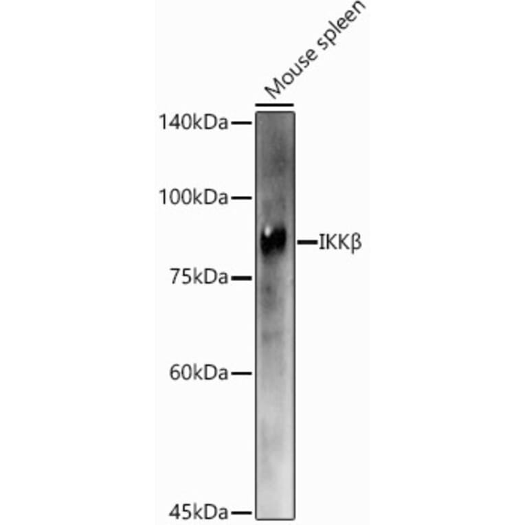 Western Blot - Anti-IKK beta Antibody (A13857) - Antibodies.com