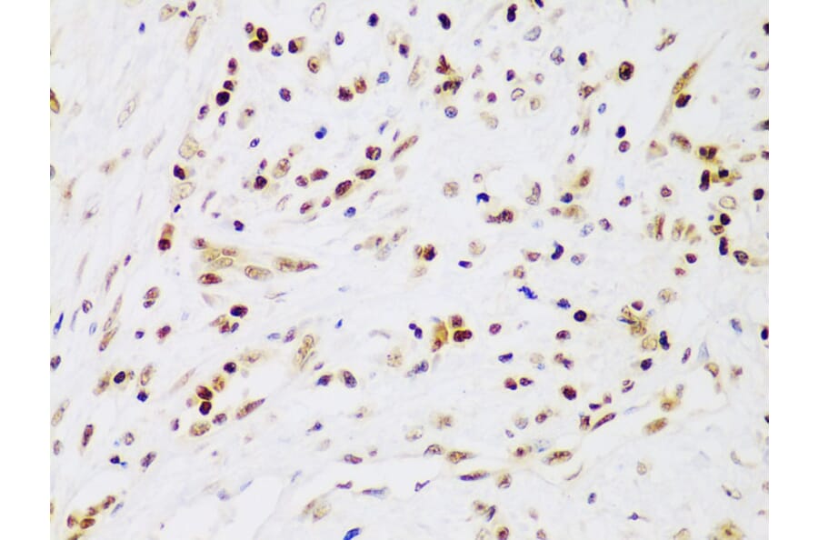 Immunohistochemistry - Anti-IKK beta Antibody (A13857) - Antibodies.com