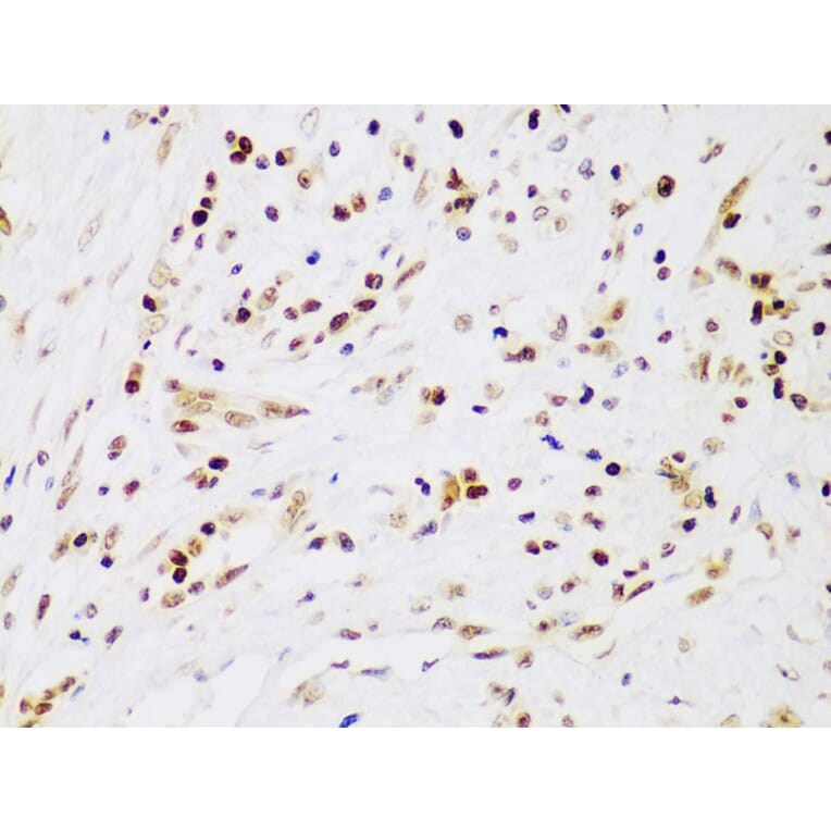 Immunohistochemistry - Anti-IKK beta Antibody (A13857) - Antibodies.com