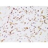 Immunohistochemistry - Anti-IKK beta Antibody (A13857) - Antibodies.com