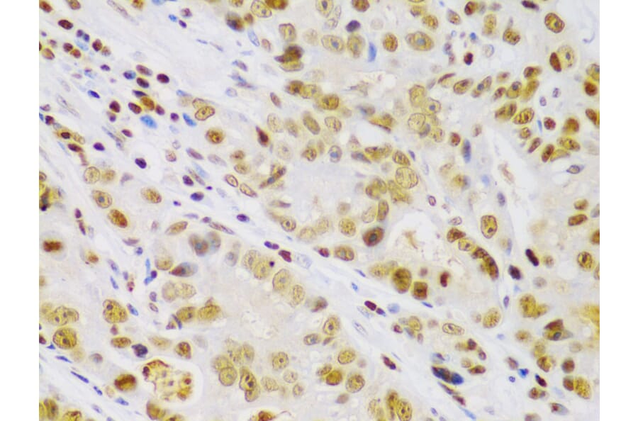 Immunohistochemistry - Anti-IKK beta Antibody (A13857) - Antibodies.com