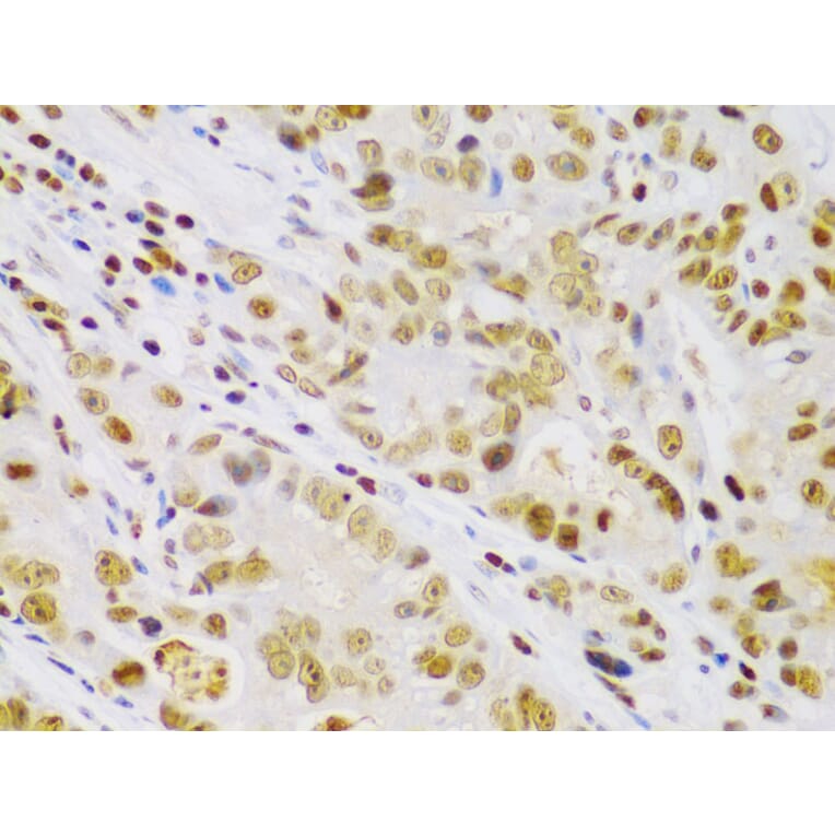 Immunohistochemistry - Anti-IKK beta Antibody (A13857) - Antibodies.com