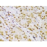 Immunohistochemistry - Anti-IKK beta Antibody (A13857) - Antibodies.com