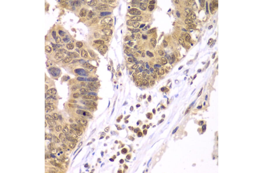 Immunohistochemistry - Anti-IKK beta Antibody (A13857) - Antibodies.com
