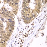 Immunohistochemistry - Anti-IKK beta Antibody (A13857) - Antibodies.com