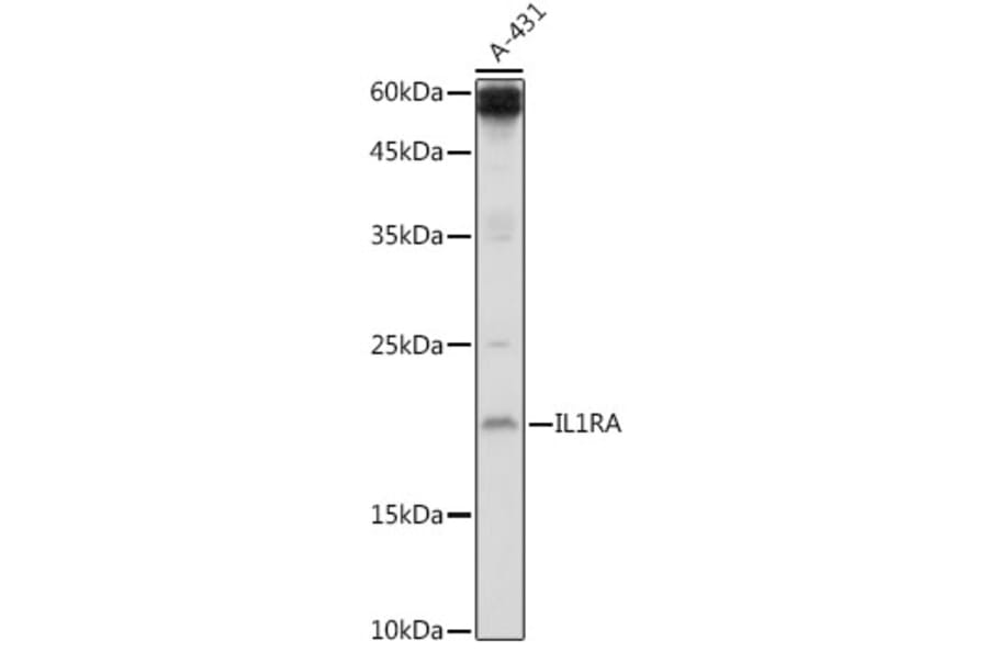 Western Blot - Anti-IL-1RA Antibody (A13858) - Antibodies.com