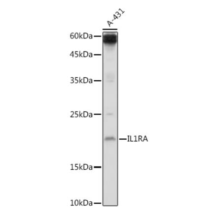 Western Blot - Anti-IL-1RA Antibody (A13858) - Antibodies.com