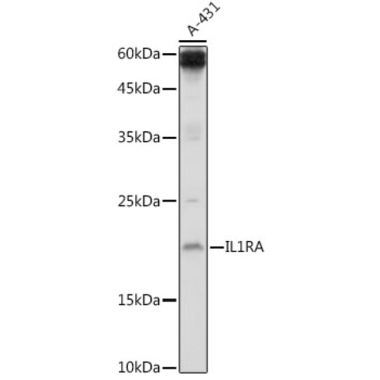Western Blot - Anti-IL-1RA Antibody (A13858) - Antibodies.com