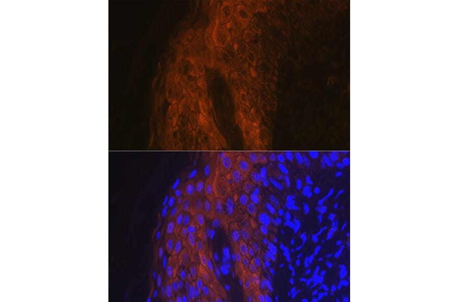 Immunofluorescence - Anti-IL-1RA Antibody (A13858) - Antibodies.com