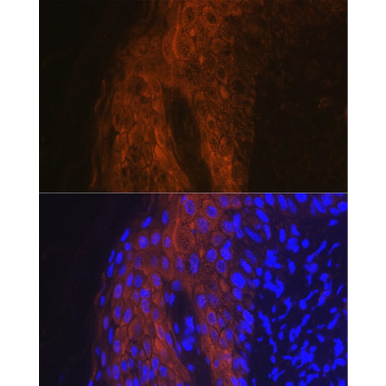 Immunofluorescence - Anti-IL-1RA Antibody (A13858) - Antibodies.com