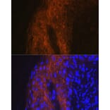 Immunofluorescence - Anti-IL-1RA Antibody (A13858) - Antibodies.com