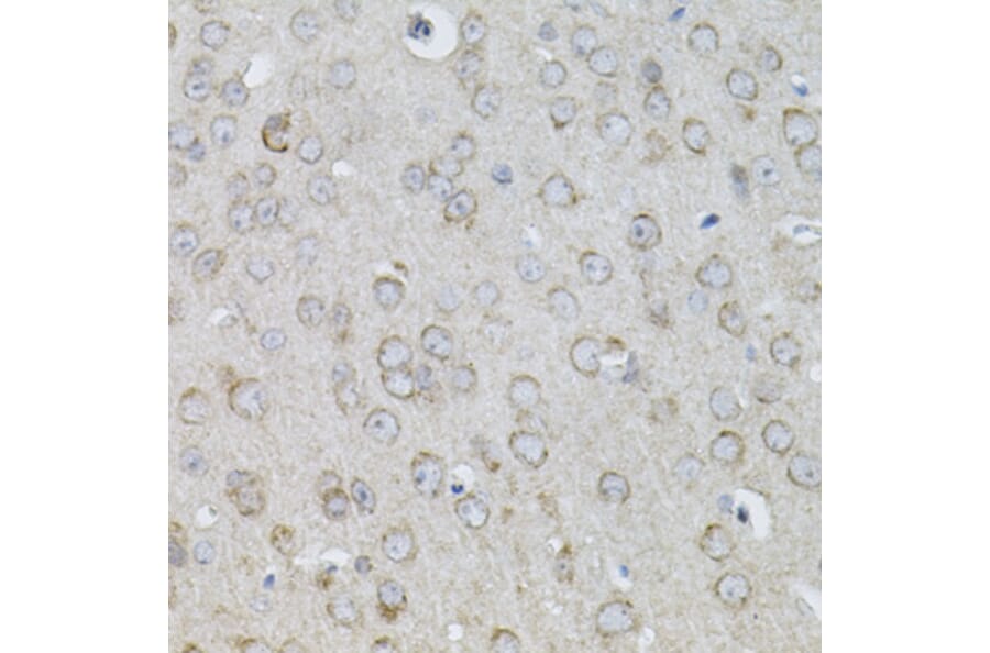 Immunohistochemistry - Anti-IL-13 Antibody (A13859) - Antibodies.com