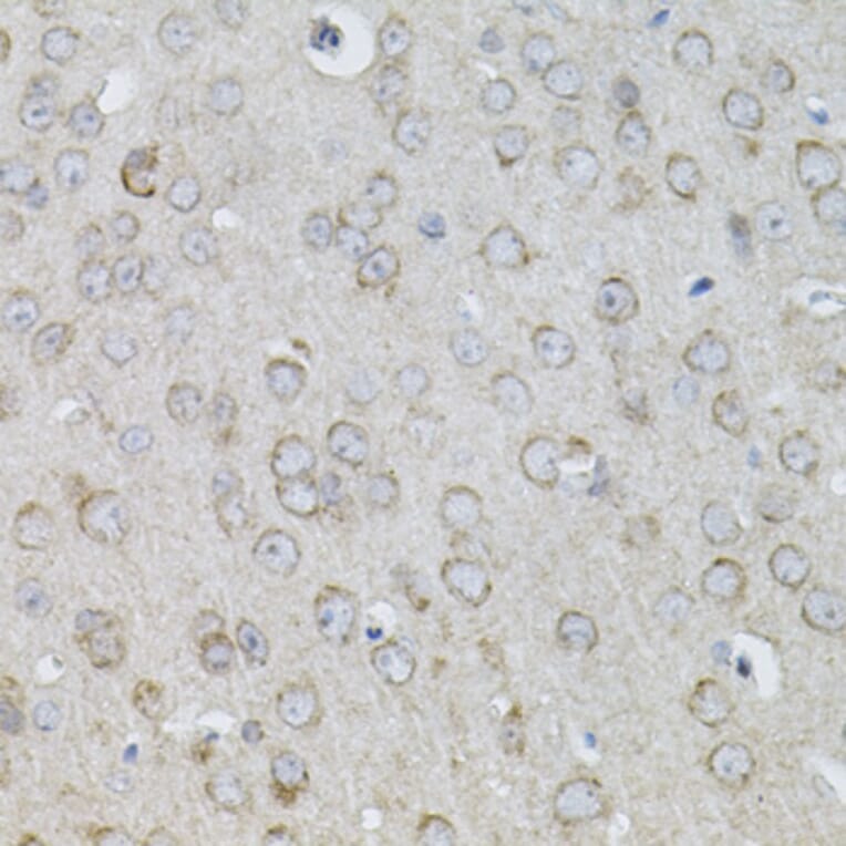 Immunohistochemistry - Anti-IL-13 Antibody (A13859) - Antibodies.com