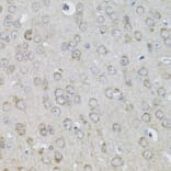 Immunohistochemistry - Anti-IL-13 Antibody (A13859) - Antibodies.com
