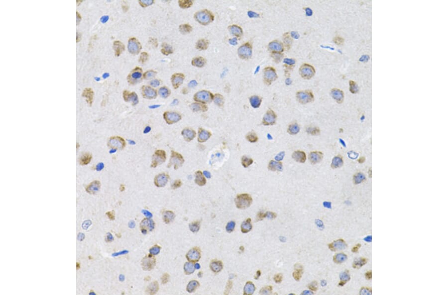 Immunohistochemistry - Anti-IL-13 Antibody (A13859) - Antibodies.com