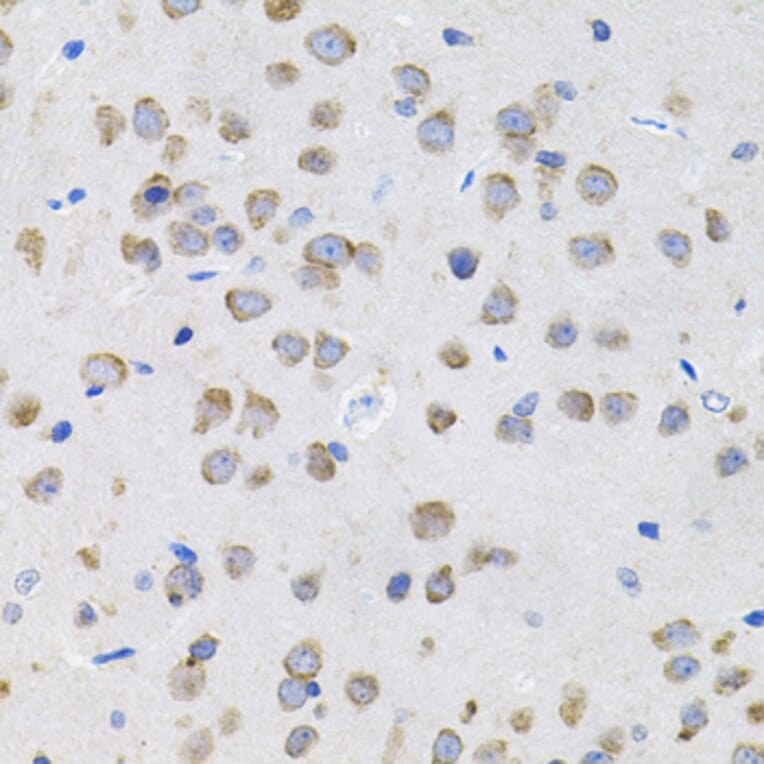 Immunohistochemistry - Anti-IL-13 Antibody (A13859) - Antibodies.com
