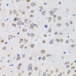 Immunohistochemistry - Anti-IL-13 Antibody (A13859) - Antibodies.com