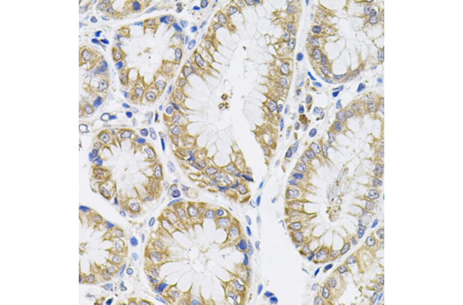 Immunohistochemistry - Anti-IL-13 Antibody (A13859) - Antibodies.com