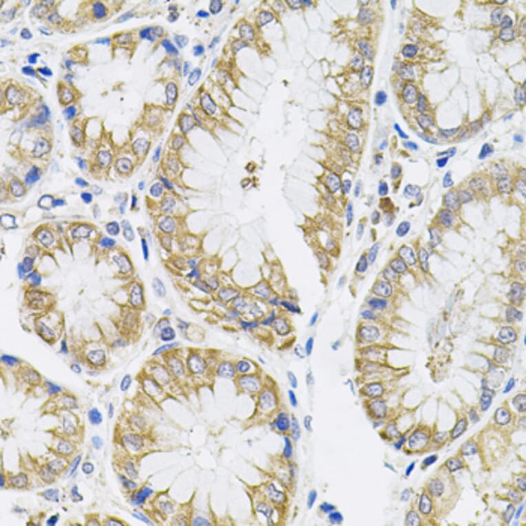 Immunohistochemistry - Anti-IL-13 Antibody (A13859) - Antibodies.com