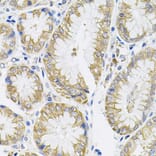 Immunohistochemistry - Anti-IL-13 Antibody (A13859) - Antibodies.com