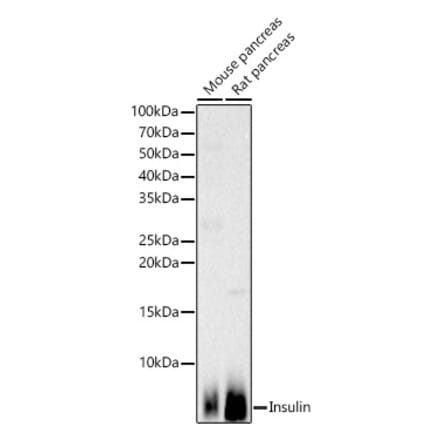 Western Blot - Anti-Insulin Antibody (A13860) - Antibodies.com