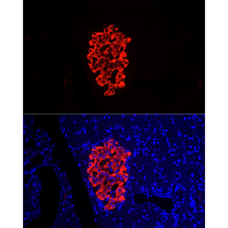 Immunofluorescence - Anti-Insulin Antibody (A13860) - Antibodies.com