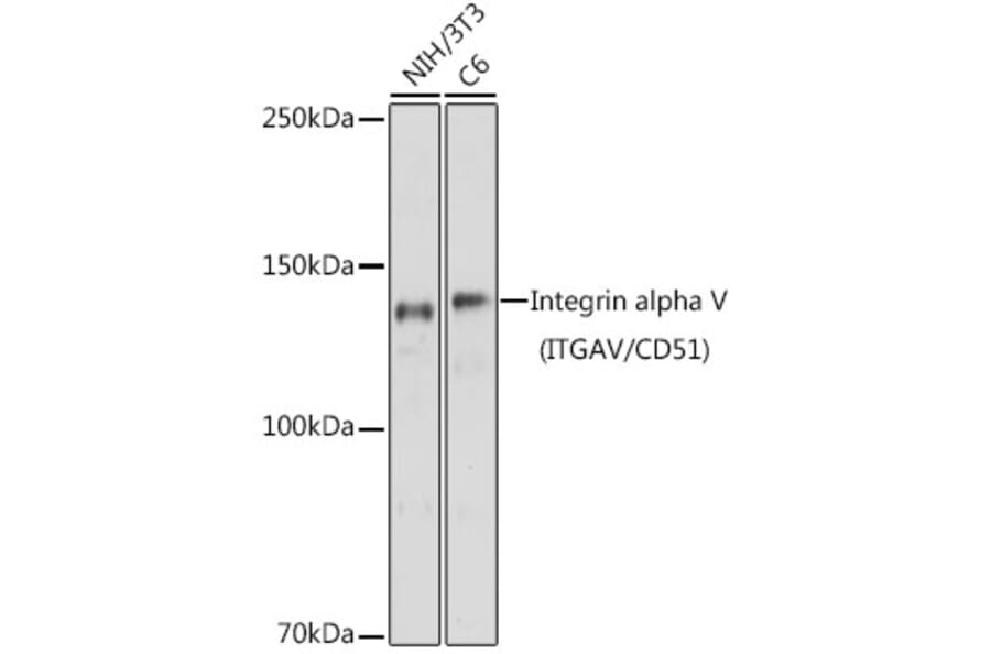 Western Blot - Anti-Integrin alpha V Antibody (A13861) - Antibodies.com