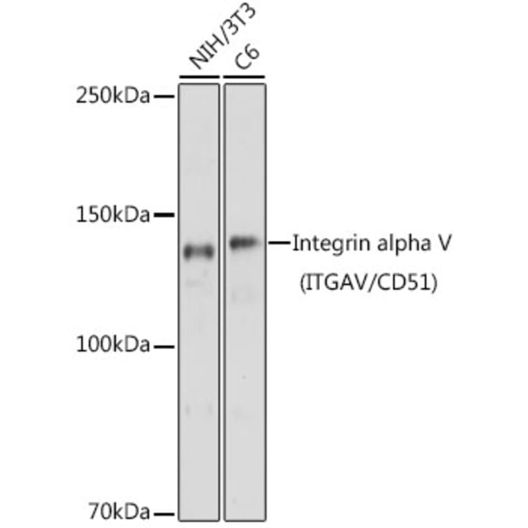 Western Blot - Anti-Integrin alpha V Antibody (A13861) - Antibodies.com