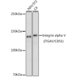 Western Blot - Anti-Integrin alpha V Antibody (A13861) - Antibodies.com