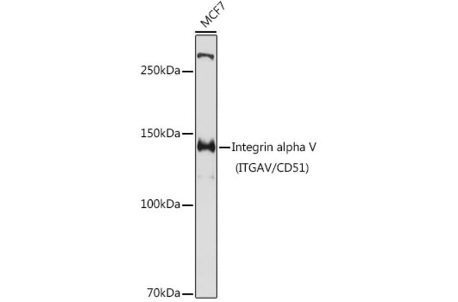 Western Blot - Anti-Integrin alpha V Antibody (A13861) - Antibodies.com