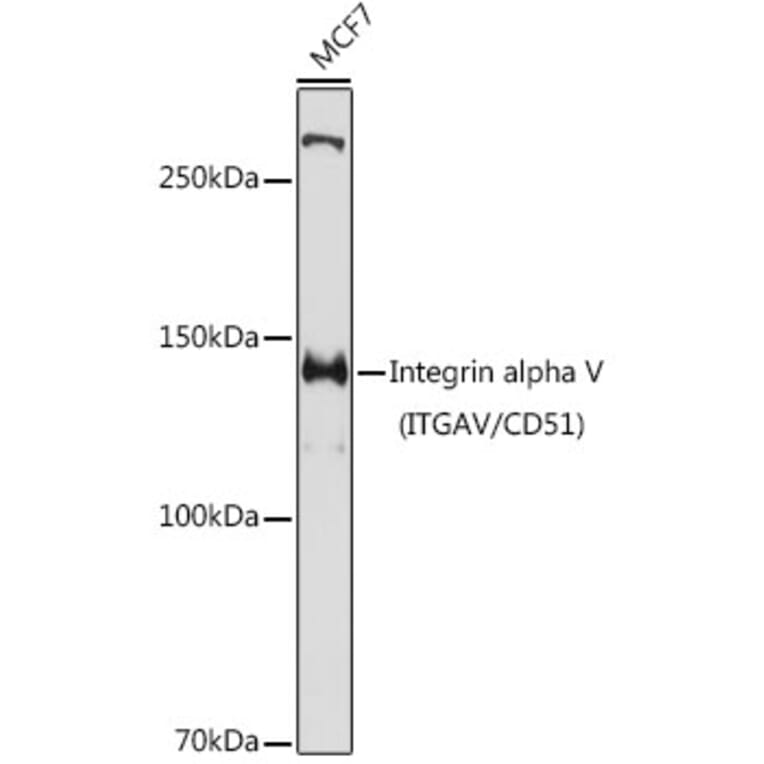 Western Blot - Anti-Integrin alpha V Antibody (A13861) - Antibodies.com