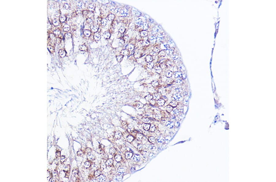 Immunohistochemistry - Anti-Integrin alpha V Antibody (A13861) - Antibodies.com